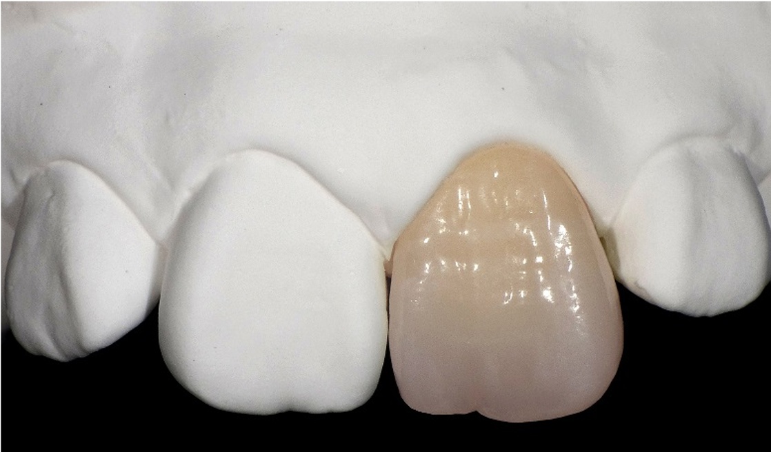 Disque ZR Lucent - CAD-CAM et numérique - Prothèse - SDC