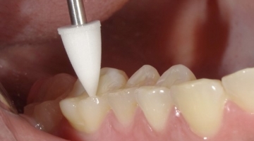 Cas pratique midi-point