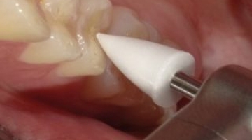 Cas pratique midi-point
