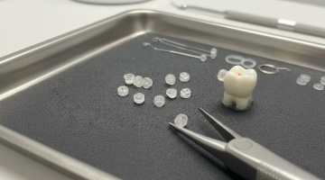 Pr�sentationd de boutons � coller en r�sine